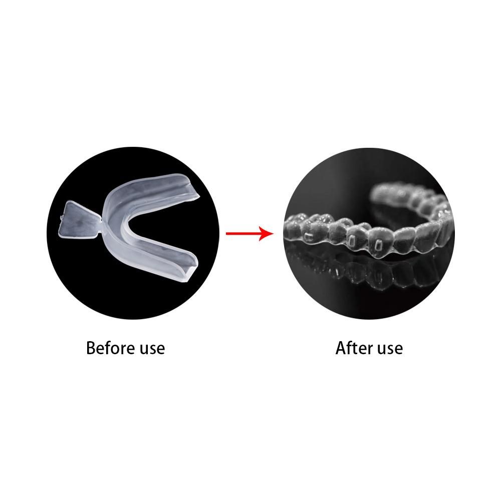 Beschermer Bruxisme Tandenhoez - Teeth Whitening With Trays recensie en prijs