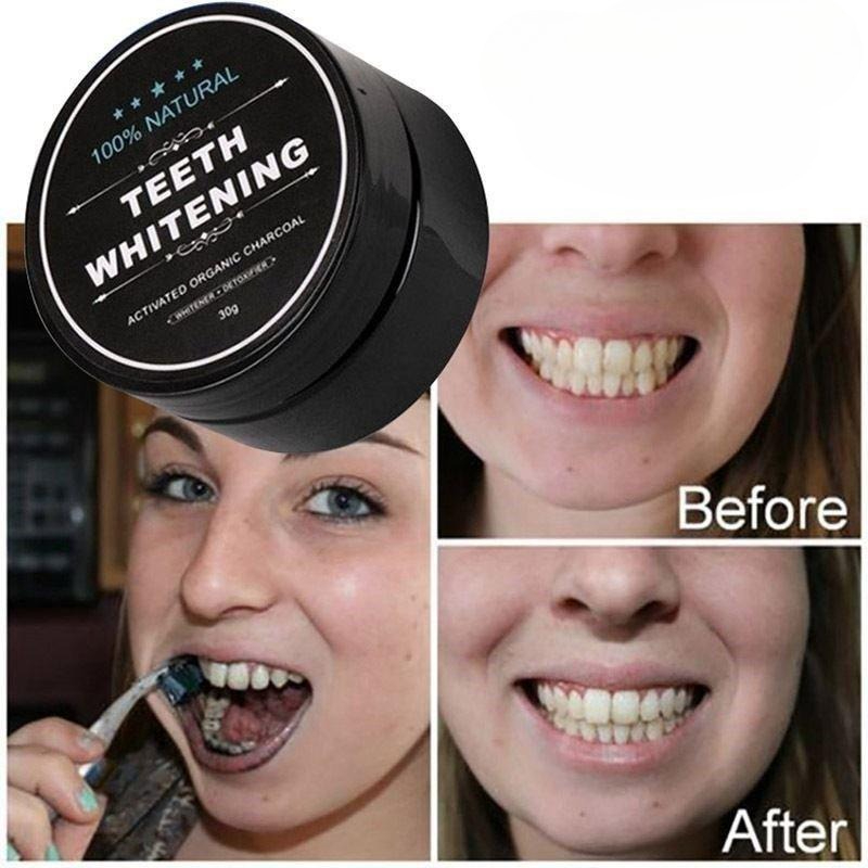 1 doos geactiveerd houtskool t - Whitening Powder Activated recensie en prijs