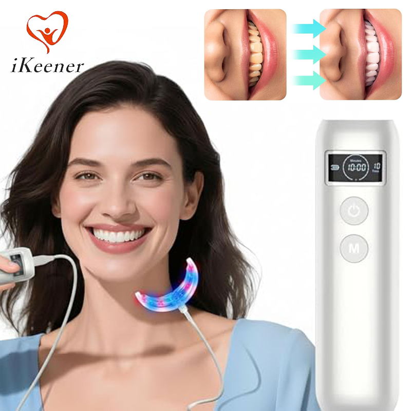 Tandenbleek-accelerator met 16 - Teeth Whitening With Trays recensie en prijs